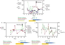 Acquired immune thrombotic thrombocytopenic purpura (TTP) associated with inactivated COVID-19 vaccine CoronaVac