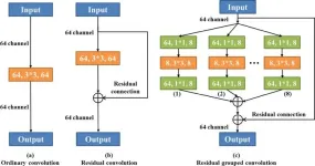 Advanced U-net segmentation model using residual grouped convolution and attention mechanism for brain tumor MRI image segmentation