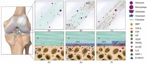 Advancements in artificial ligaments for ACL reconstruction: A leap towards improved outcomes