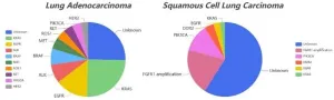 Advancing lung cancer treatment: Understanding the differences between LUAD and LUSC