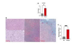 Aging exacerbates oxidative stress and liver fibrosis in an animal model of Down Syndrome