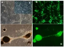 Aging-US: Aging and rejuvenation - a modular epigenome model