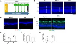 Aging-US: Nicotinamide mononucleotide in degenerative model of retinal detachment