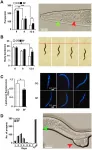 Aging-US: Sulforaphane promotes C. elegans longevity and healthspan