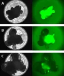 AI beats experts in predicting future quality of “mini-organs”