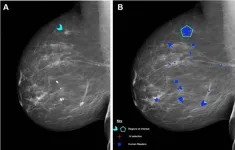 AI performs comparably to human readers of mammograms