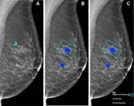 AI performs comparably to human readers of mammograms 2