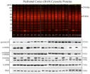 Alcohol abuse damage in neurones at a molecular scale identified for first time