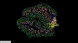 Allen Institute for Immunology and Seattle Children’s Research Institute launch study to unravel molecular mysteries of pediatric IBD