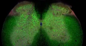 ALS development could be triggered by loss of network connections in the spinal cord