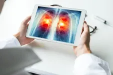 American Cancer Society updates lung cancer screening guideline: Nearly five million US adults who smoke and formerly smoked now recommended for testing