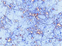 An astounding find reveals a rare cause of epilepsy