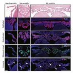 An atlas of the brains choroid plexus across the lifespan