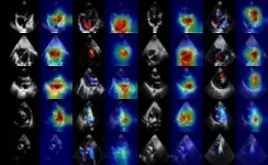 An auxiliary CHD diagnostic system based on multi-view and multi-modal transthoracic echocardiograms 2