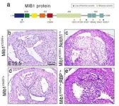 An international team identifies the mutations that cause the most frequent congenital heart defects 3