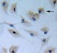 An obstacle to the differentiation of adipose-derived stromal cells into astrocytes