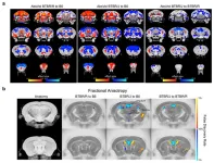 Ancient virus genome drives autism?