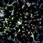 Antidepressant shows promise for treating brain tumors 2