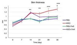 Antioxidant Dietary Supplement “Twendee X®” can help counter systemic sclerosis 3