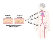 APOE genetic variants linked to Alzheimer disease are also associated with the development of subclinical aterosclerosis 2