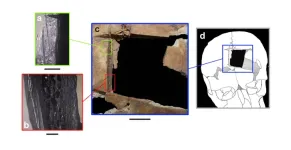 Archaeologists uncover early evidence of brain surgery in Ancient Near East