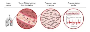 Artificial intelligence blood test provides a reliable way to identify lung cancer