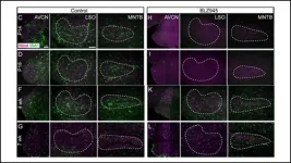 Auditory brainstem pathways do not develop properly without microglia