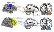 Autisms early neuronal neighborhood