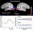 Autistic adults have unreliable neural responses, Carnegie Mellon-led research team finds