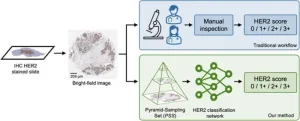 Automated HER2 scoring in breast cancer images using deep learning and pyramid sampling