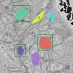 Automatic cell analysis with the help of artificial intelligence 2