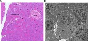 Autophagy in pancreatitis 2