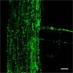 Bacterial community inside the plant root