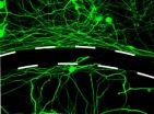 Barrier-breaking drug may lead to spinal cord injury treatments 2