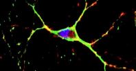 Berkeley Lab scientists help develop promising therapy for Huntington's disease