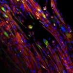 Bio-inspired scaffolds help promote muscle growth