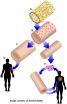 Bioengineered veins offer new hope on horizon for patients lacking healthy veins for coronary bypass surgery or dialysis