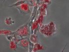 Bioengineers: Matrix stiffness is an essential tool in stem cell differentiation