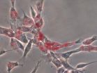 Bioengineers: Matrix stiffness is an essential tool in stem cell differentiation 2