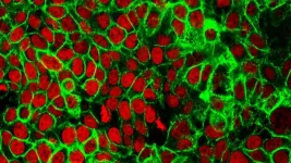 Biomed engineering student at NJIT shines a light on rare colon cancer