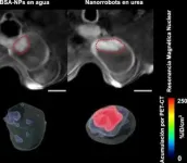 Bladder tumors reduced by 90% using nanorobots 2