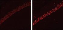 Blockade of learning and memory genes may occur early in Alzheimers disease