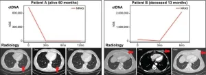 Blood-based biomarker may redefine the future treatment for advanced melanoma