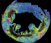 Borderzone Breakthrough: A new source of cardiac inflammation