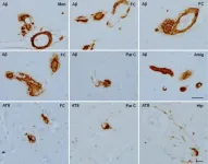 Brain aging and Alzheimers: Insights from non-human primates