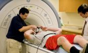 Brain changes found in football players thought to be concussion-free