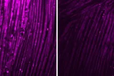 Brain inflammation triggers muscle weakness after infections