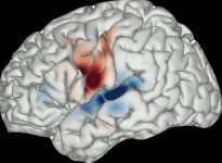 Brain mapping advances understanding of human speech and hallucinations in schizophrenia