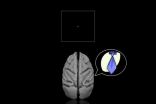 Brain network that controls, redirects attention identified 3