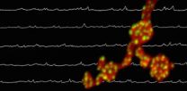 Brain noise found to nurture synapses